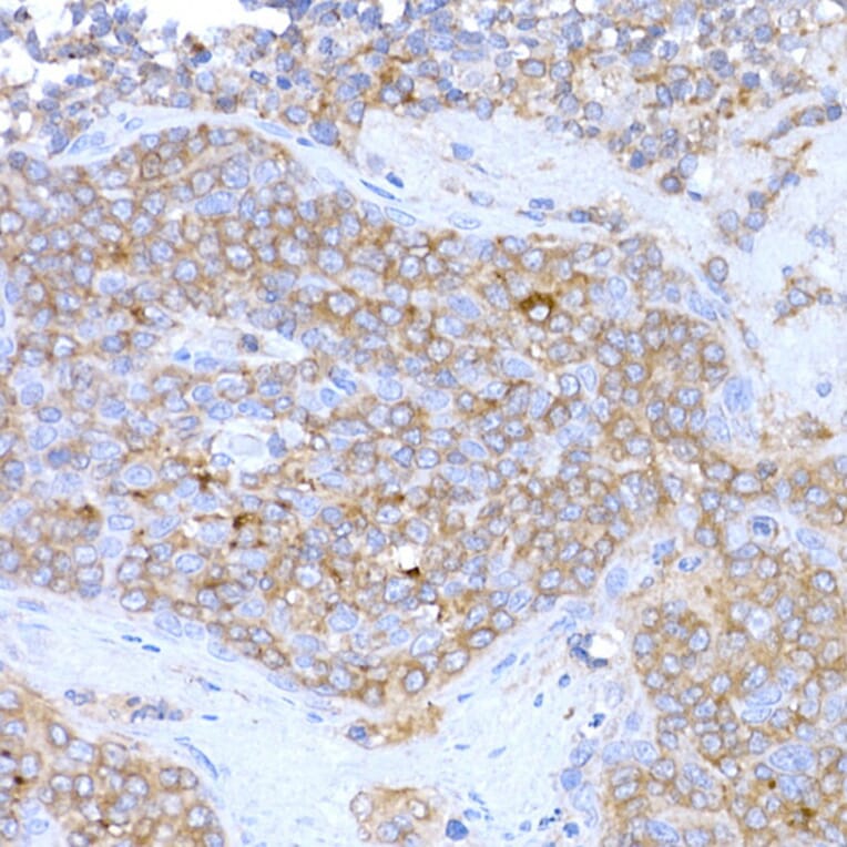 Immunohistochemistry - Anti-MAGED1/NRAGE Antibody (A13138) - Antibodies.com