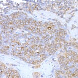 Immunohistochemistry - Anti-MAGED1/NRAGE Antibody (A13138) - Antibodies.com