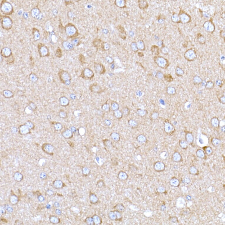 Immunohistochemistry - Anti-MAGED1/NRAGE Antibody (A13138) - Antibodies.com