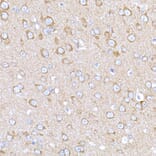 Immunohistochemistry - Anti-MAGED1/NRAGE Antibody (A13138) - Antibodies.com