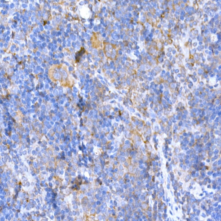 Immunohistochemistry - Anti-MAGED1/NRAGE Antibody (A13138) - Antibodies.com