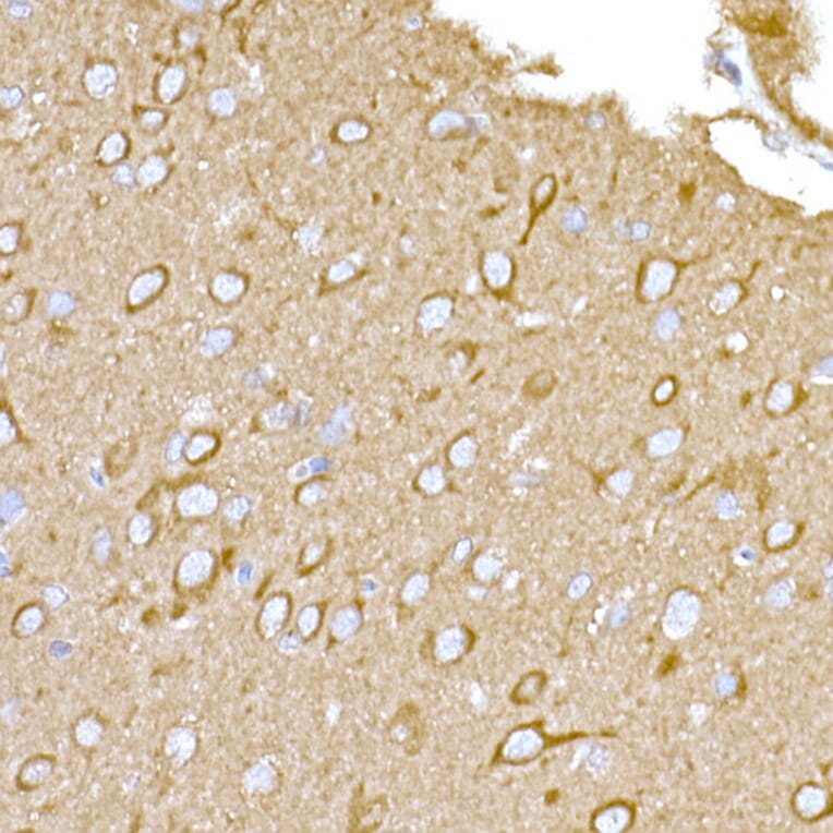 Immunohistochemistry - Anti-MAGED1/NRAGE Antibody (A13138) - Antibodies.com
