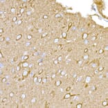 Immunohistochemistry - Anti-MAGED1/NRAGE Antibody (A13138) - Antibodies.com