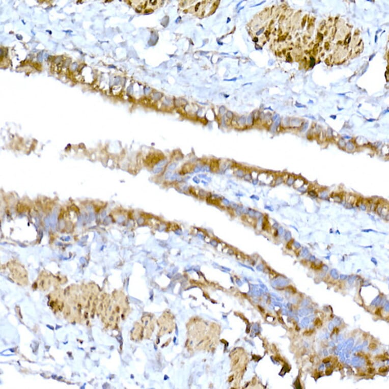 Immunohistochemistry - Anti-MAGED1/NRAGE Antibody (A13138) - Antibodies.com