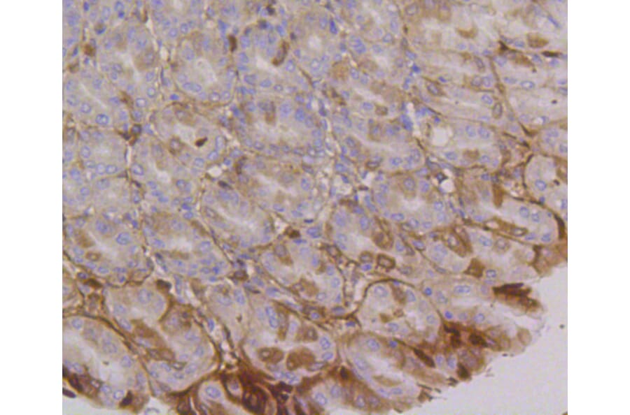 Immunohistochemistry - Anti-ITGA6 Antibody (A10924) - Antibodies.com