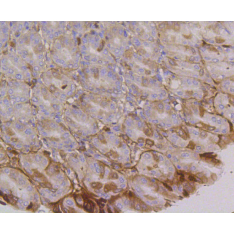 Immunohistochemistry - Anti-ITGA6 Antibody (A10924) - Antibodies.com