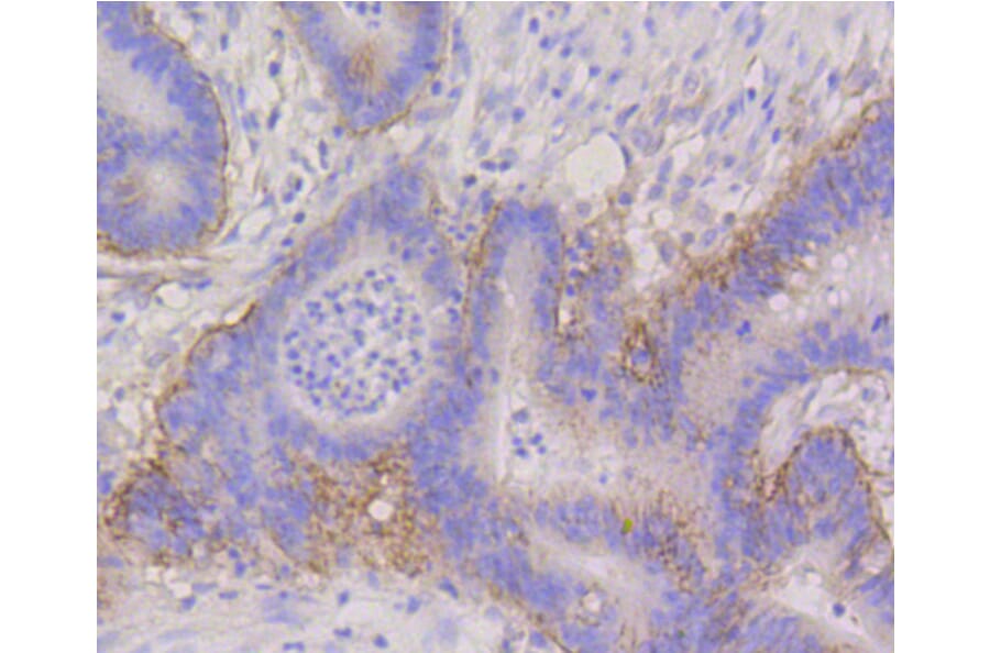 Immunohistochemistry - Anti-ITGA6 Antibody (A10924) - Antibodies.com