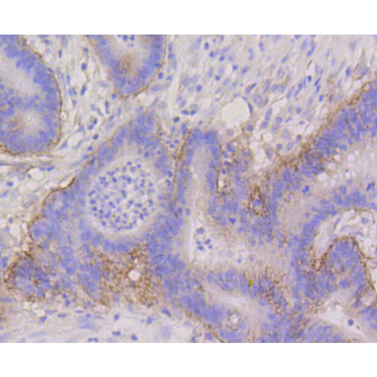 Immunohistochemistry - Anti-ITGA6 Antibody (A10924) - Antibodies.com
