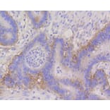 Immunohistochemistry - Anti-ITGA6 Antibody (A10924) - Antibodies.com