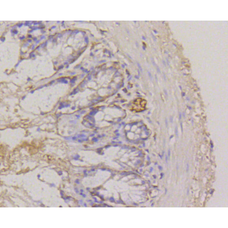 Immunohistochemistry - Anti-ITGA6 Antibody (A10924) - Antibodies.com