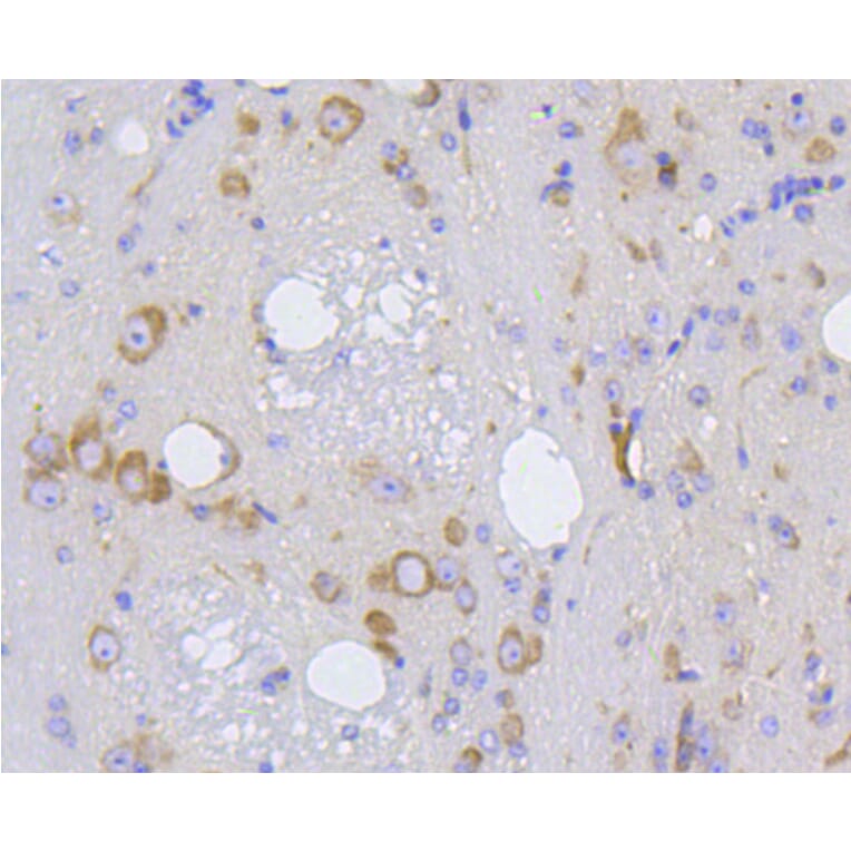 Immunohistochemistry - Anti-IRF1 Antibody (A10927) - Antibodies.com