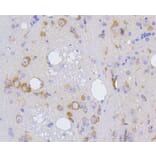 Immunohistochemistry - Anti-IRF1 Antibody (A10927) - Antibodies.com