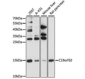 Western Blot - Anti-SF20 Antibody (A13145) - Antibodies.com