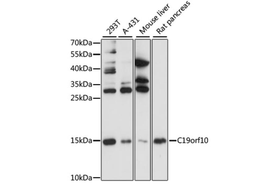 Western Blot - Anti-SF20 Antibody (A13145) - Antibodies.com