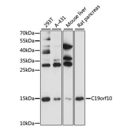 Western Blot - Anti-SF20 Antibody (A13145) - Antibodies.com