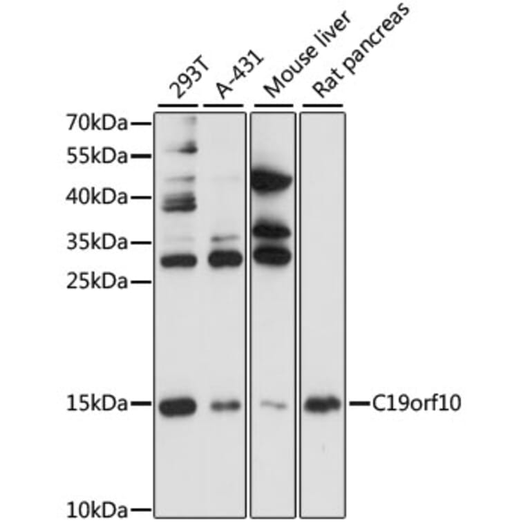 Western Blot - Anti-SF20 Antibody (A13145) - Antibodies.com