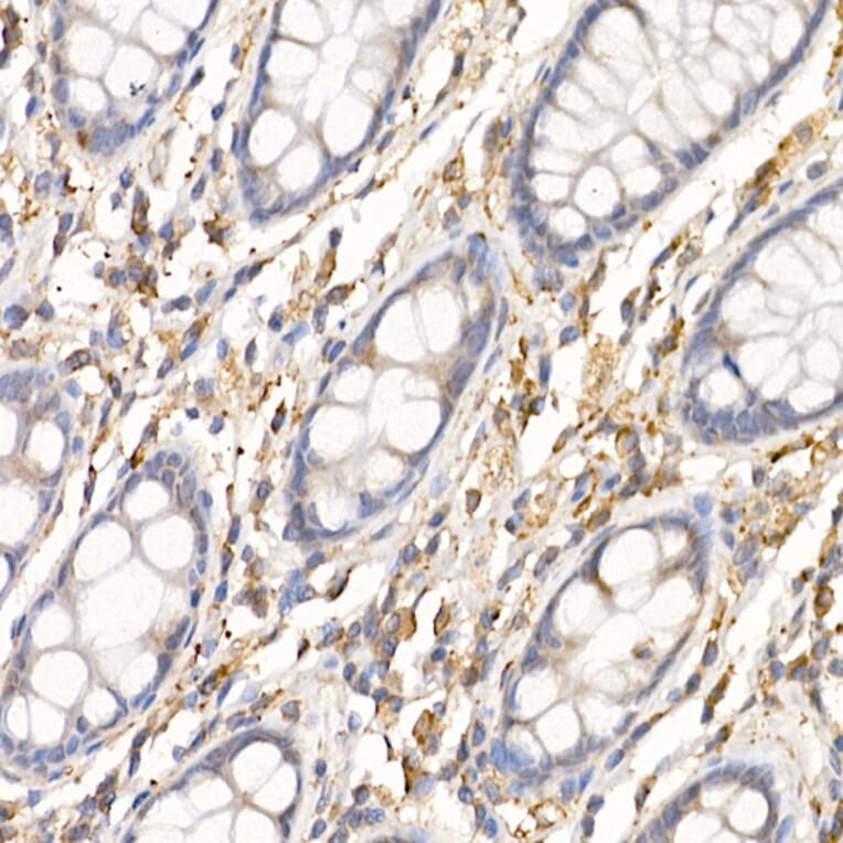Immunohistochemistry - Anti-SF20 Antibody (A13145) - Antibodies.com
