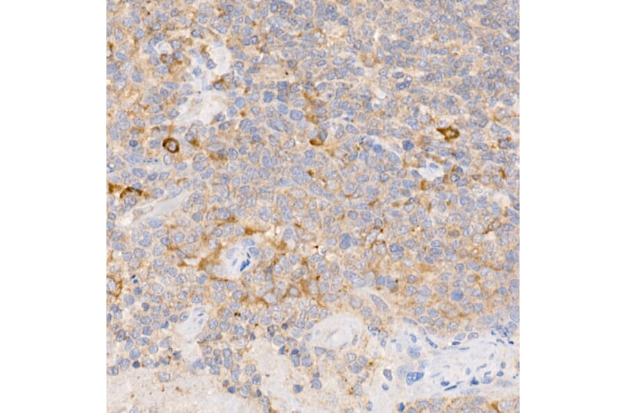 Immunohistochemistry - Anti-SF20 Antibody (A13145) - Antibodies.com