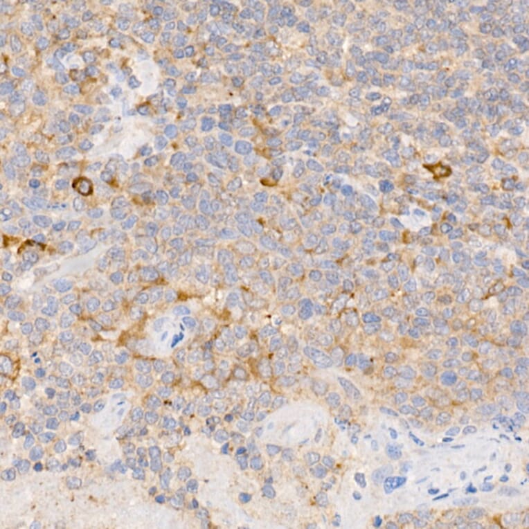 Immunohistochemistry - Anti-SF20 Antibody (A13145) - Antibodies.com