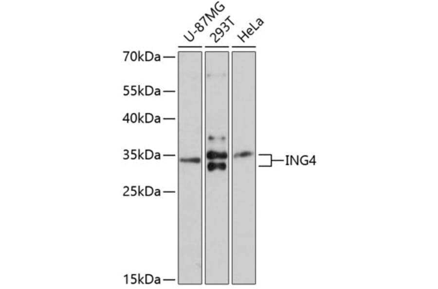 Western Blot - Anti-ING4 Antibody (A10932) - Antibodies.com