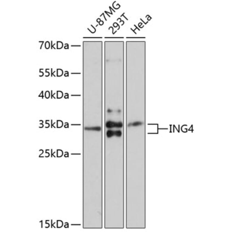 Western Blot - Anti-ING4 Antibody (A10932) - Antibodies.com