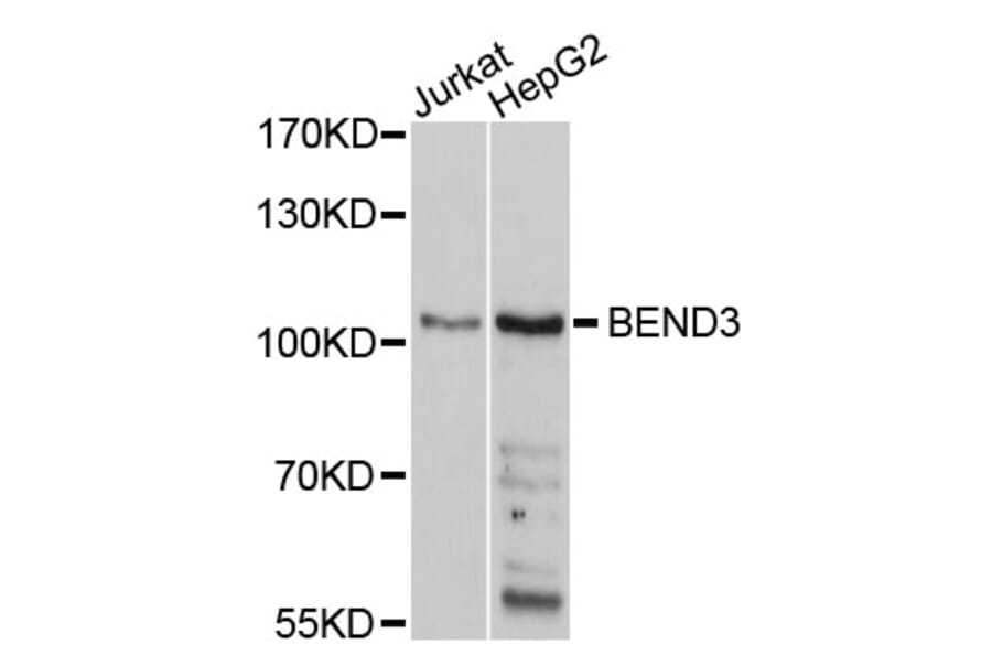 Western Blot - Anti-BEND3 Antibody (A10938) - Antibodies.com