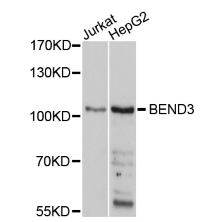 Western Blot - Anti-BEND3 Antibody (A10938) - Antibodies.com