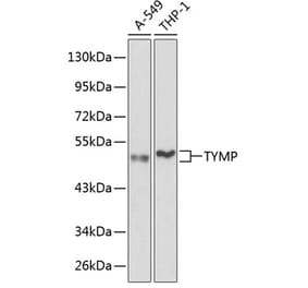 Western Blot - Anti-Thymidine Phosphorylase Antibody (A13152) - Antibodies.com