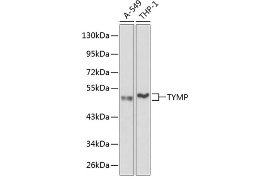 Anti-Thymidine Phosphorylase Antibody (A13152) | Antibodies.com