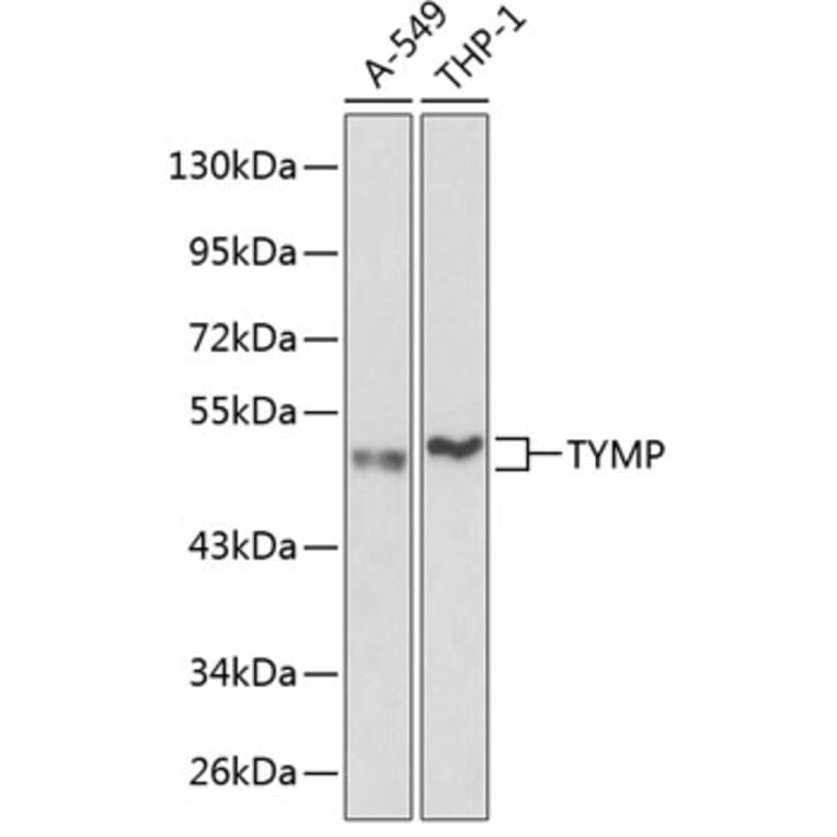 Western Blot - Anti-Thymidine Phosphorylase Antibody (A13152) - Antibodies.com