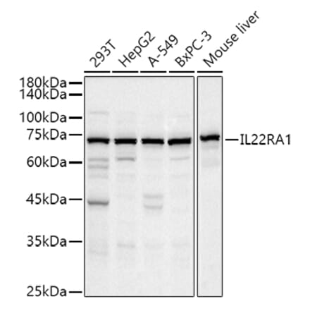 Western Blot - Anti-IL-22RA1 Antibody (A13154) - Antibodies.com