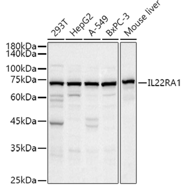 Western Blot - Anti-IL-22RA1 Antibody (A13154) - Antibodies.com