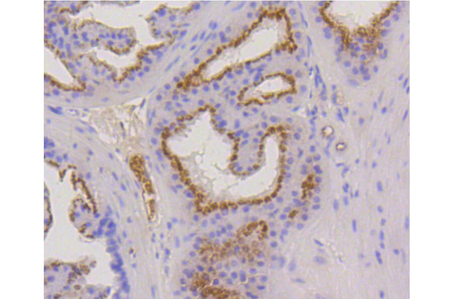 Immunohistochemistry - Anti-KRT17 Antibody (A10942) - Antibodies.com