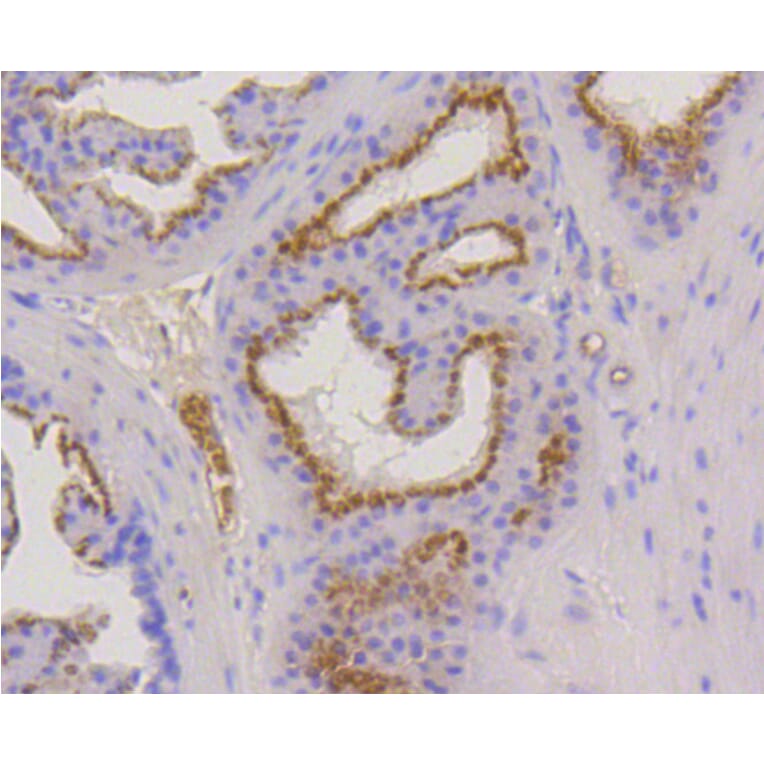 Immunohistochemistry - Anti-KRT17 Antibody (A10942) - Antibodies.com