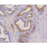 Immunohistochemistry - Anti-KRT17 Antibody (A10942) - Antibodies.com