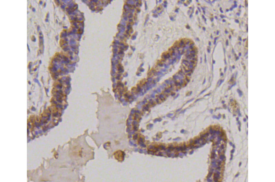 Immunohistochemistry - Anti-KRT17 Antibody (A10942) - Antibodies.com