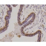 Immunohistochemistry - Anti-KRT17 Antibody (A10942) - Antibodies.com