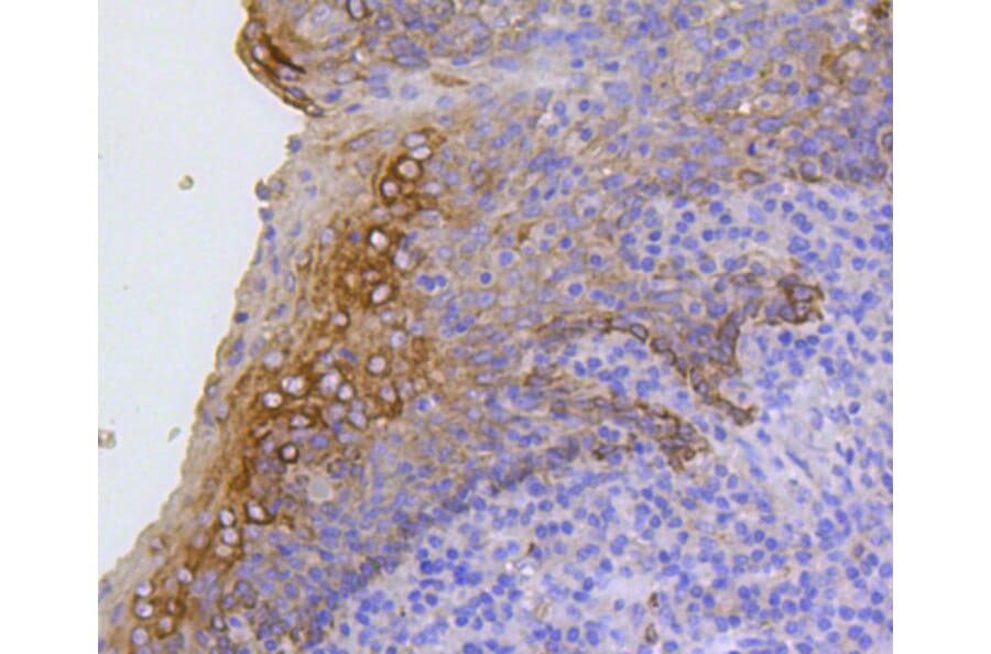 Immunohistochemistry - Anti-KRT17 Antibody (A10942) - Antibodies.com