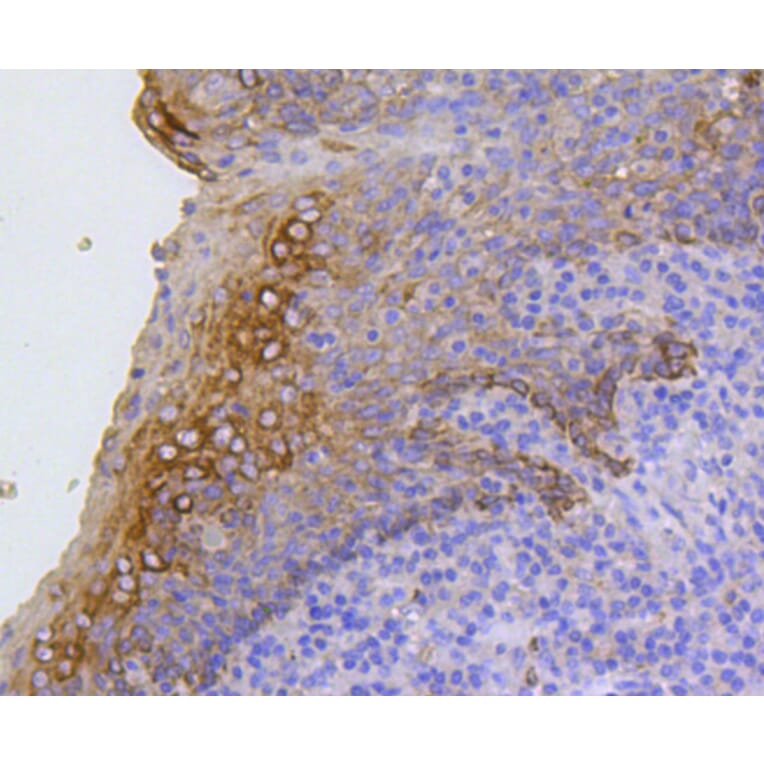 Immunohistochemistry - Anti-KRT17 Antibody (A10942) - Antibodies.com