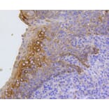 Immunohistochemistry - Anti-KRT17 Antibody (A10942) - Antibodies.com