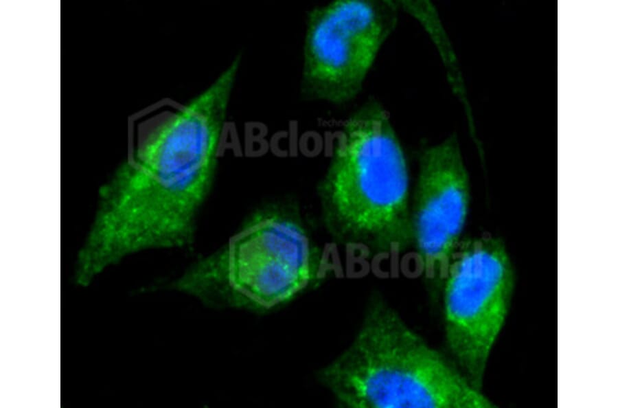 Immunofluorescence - Anti-KRT17 Antibody (A10942) - Antibodies.com