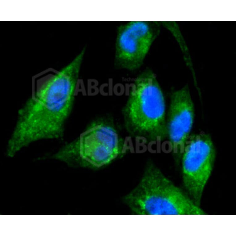 Immunofluorescence - Anti-KRT17 Antibody (A10942) - Antibodies.com