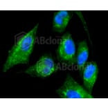 Immunofluorescence - Anti-KRT17 Antibody (A10942) - Antibodies.com