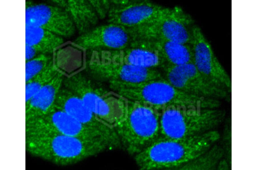 Immunofluorescence - Anti-KRT17 Antibody (A10942) - Antibodies.com