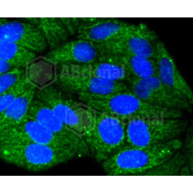 Immunofluorescence - Anti-KRT17 Antibody (A10942) - Antibodies.com