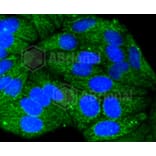 Immunofluorescence - Anti-KRT17 Antibody (A10942) - Antibodies.com