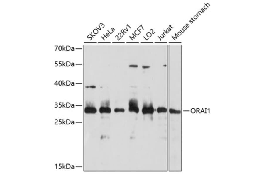 Western Blot - Anti-ORAI1 Antibody (A10953) - Antibodies.com