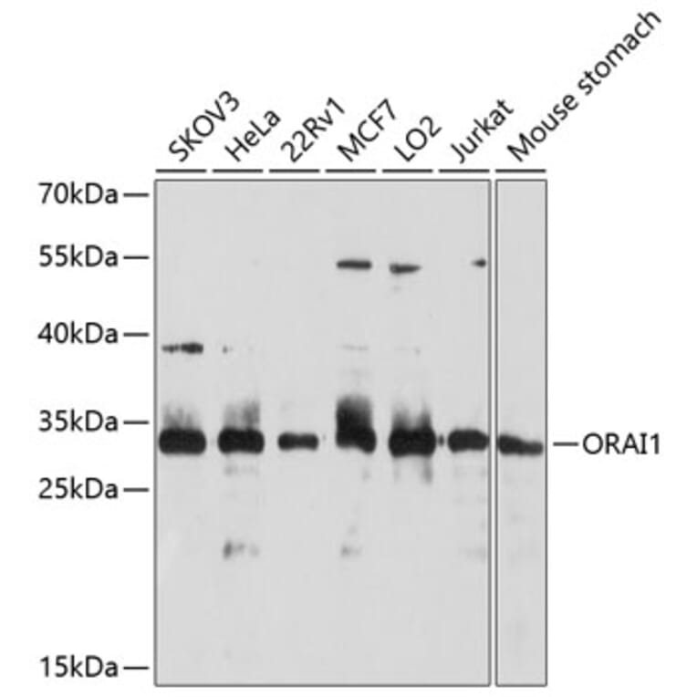 Western Blot - Anti-ORAI1 Antibody (A10953) - Antibodies.com