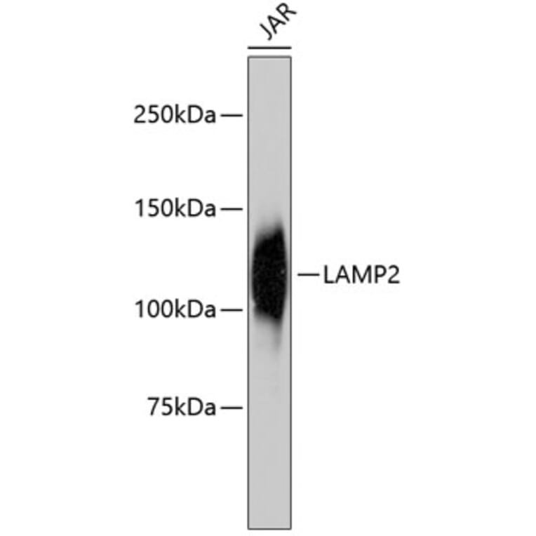 Western Blot - Anti-LAMP2 Antibody (A10954) - Antibodies.com