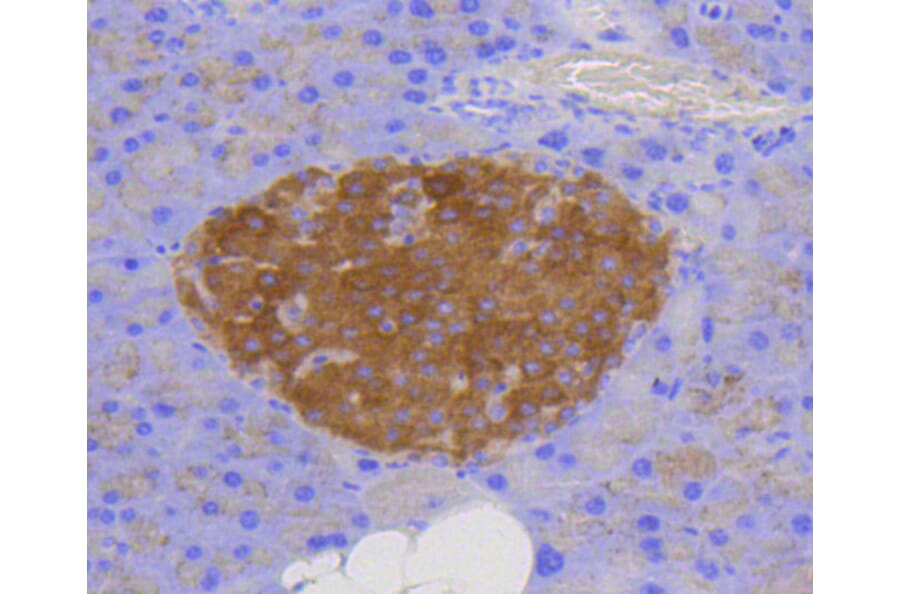 Immunohistochemistry - Anti-LAMP2 Antibody (A10954) - Antibodies.com